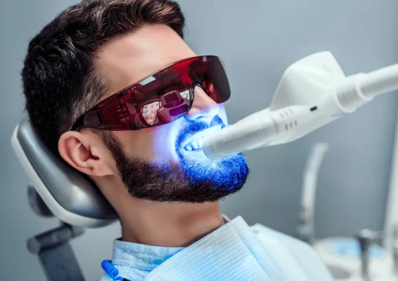 Laser Teeth Whitening